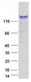 SDS-PAGE (PUM1-930HFL).jpg